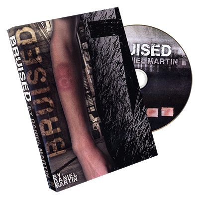 Bruised by Daniel Martin  - Trick - Got Magic?