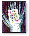 X-Ray Box by Bazar de Magia - Trick - Got Magic?